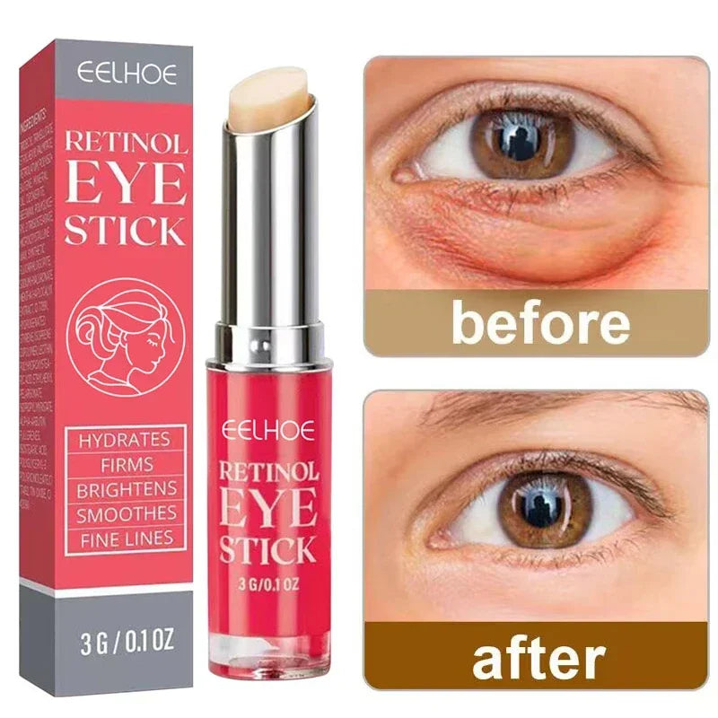 Eye Cream Retinol Remove Eye Bags Dark Circles Anti Aging Lifting