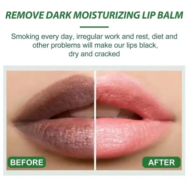 Korean Remove Dark Lip Balm