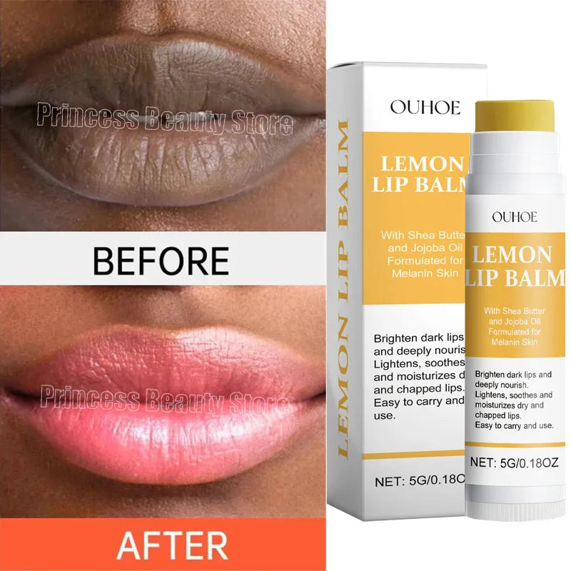 Korean Remove Dark Lip Balm