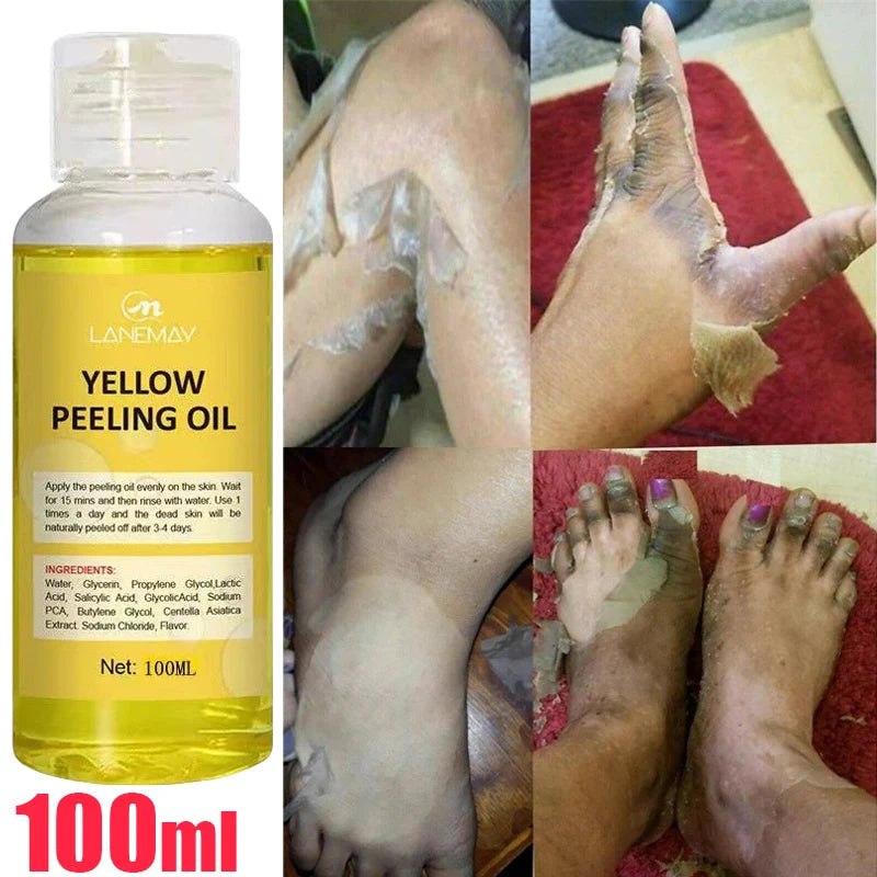 Korean Body Care Exfoliating Yellow Peeling Oil 100% Organic