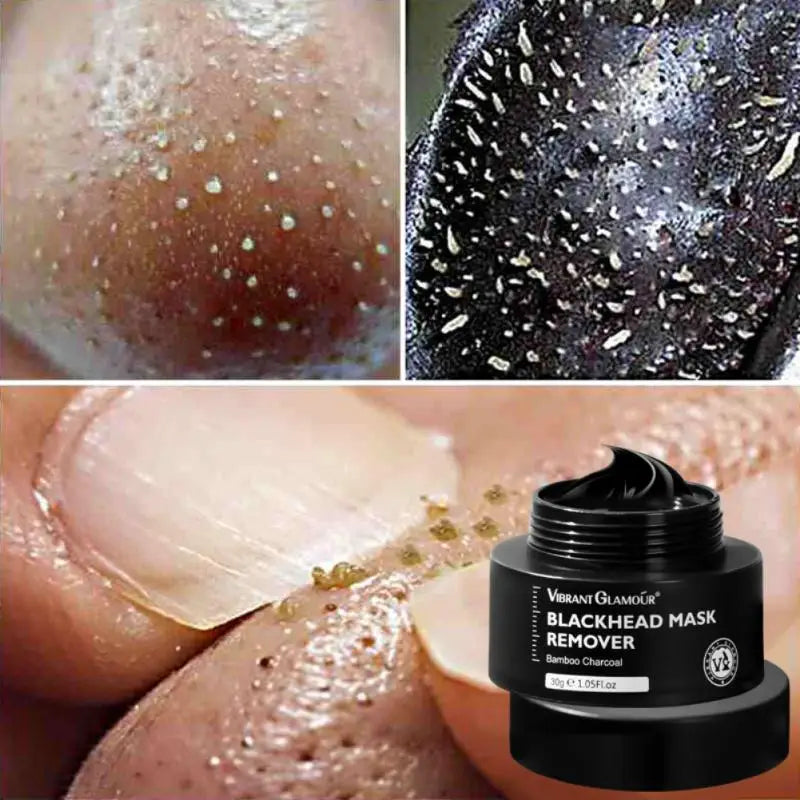 Korean Bamboo Charcoal Blackhead Remover